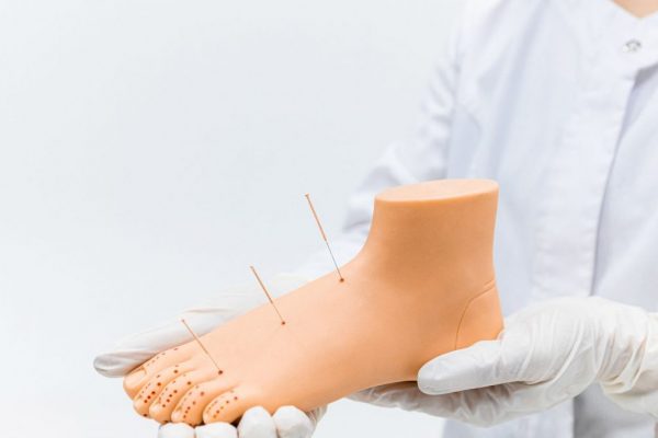 A medical practitioner demonstrates acupuncture on a foot model, highlighting needle placement.