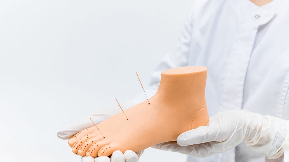 A medical practitioner demonstrates acupuncture on a foot model, highlighting needle placement.