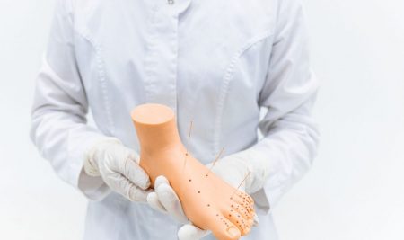 Your guide to an affordable acupuncture student clinic: 5 treatments for $150