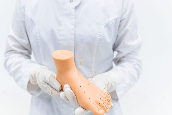 Close-up of medical practitioner holding an acupuncture foot model in a clinical setting.