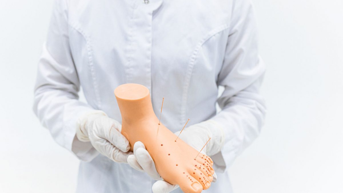 Close-up of medical practitioner holding an acupuncture foot model in a clinical setting.