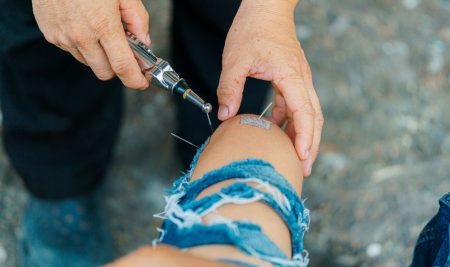 Acupuncture for Pain Management in Older Adults: What Seniors and Caregivers Should Know